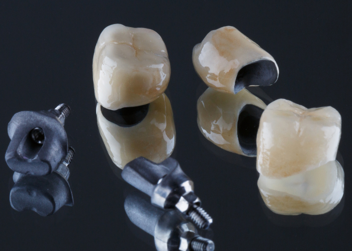 Porcelain dental crowns and abutments on a reflective surface, illustrating options for restoring damaged teeth and enhancing smiles.